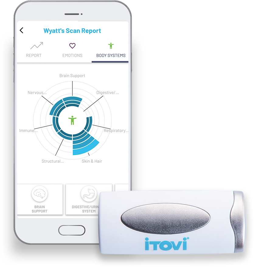 iTOVi Scan Report and Scanner