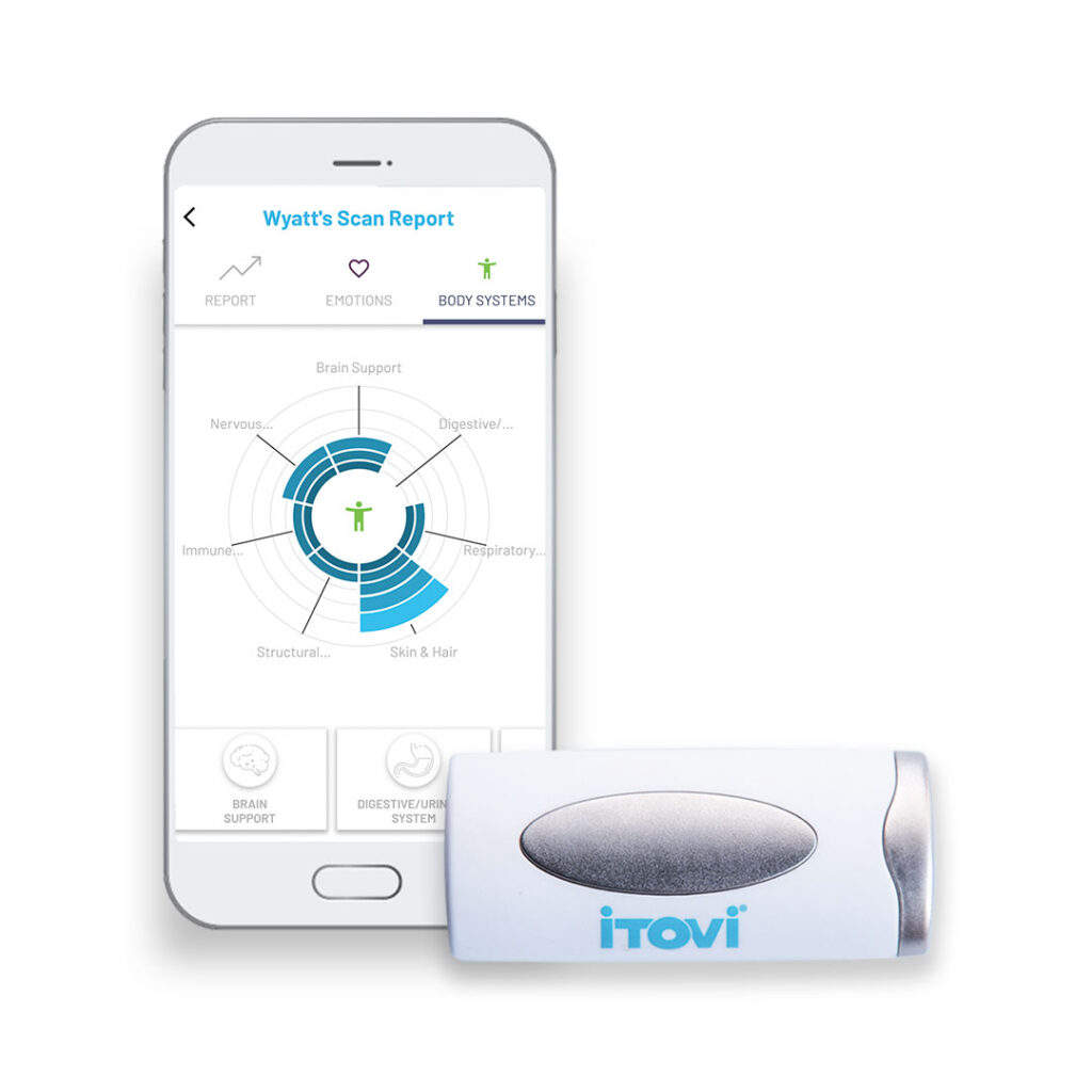 iTOVi Scan Report and Scanner